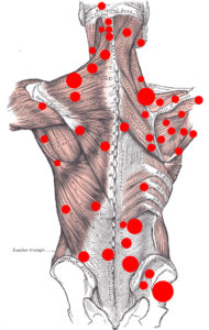 reflexologie des points triggers